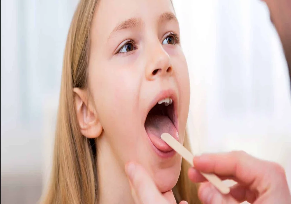 صديد اللوز للاطفال