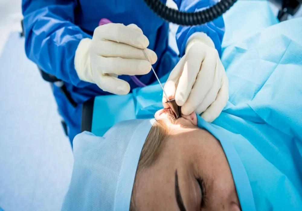 التهاب الأذن بعد عملية ترقيع الطبلة